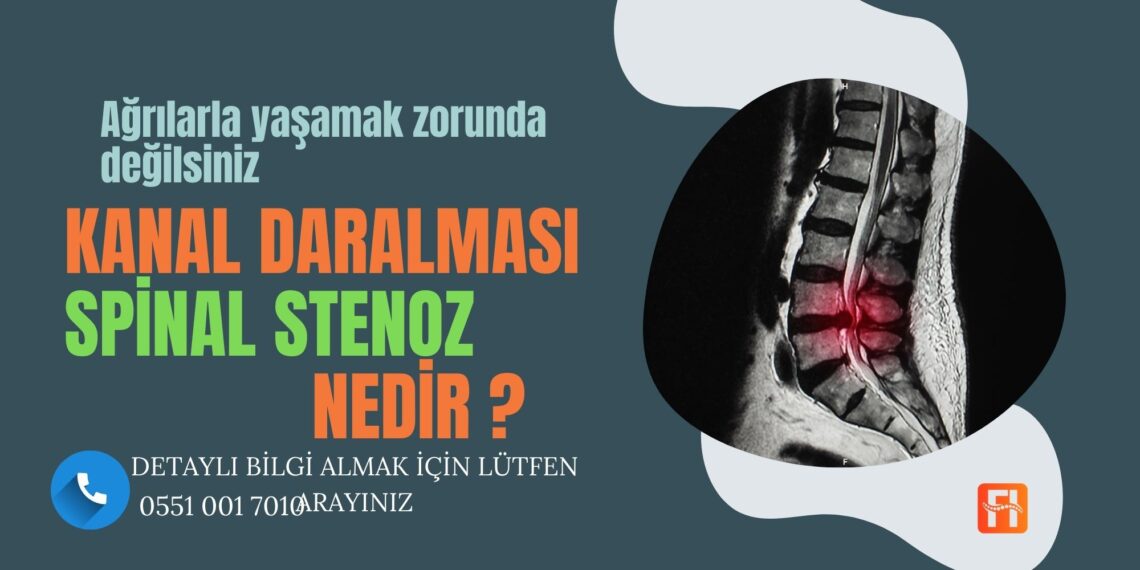 Kanal Daralması (Spinal Stenoz)