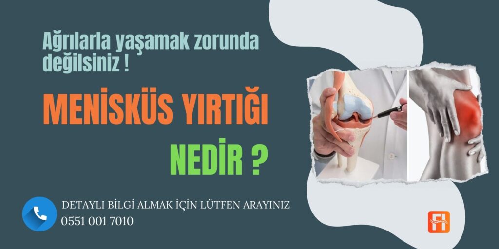 Menisküs Yırtılması