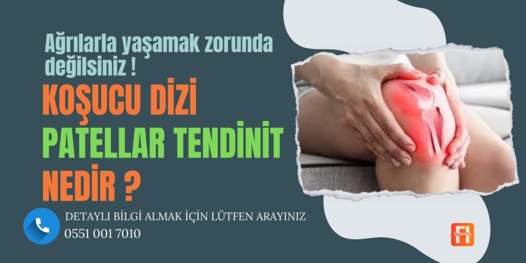 Patellar Tendinit (Koşucu Dizi)