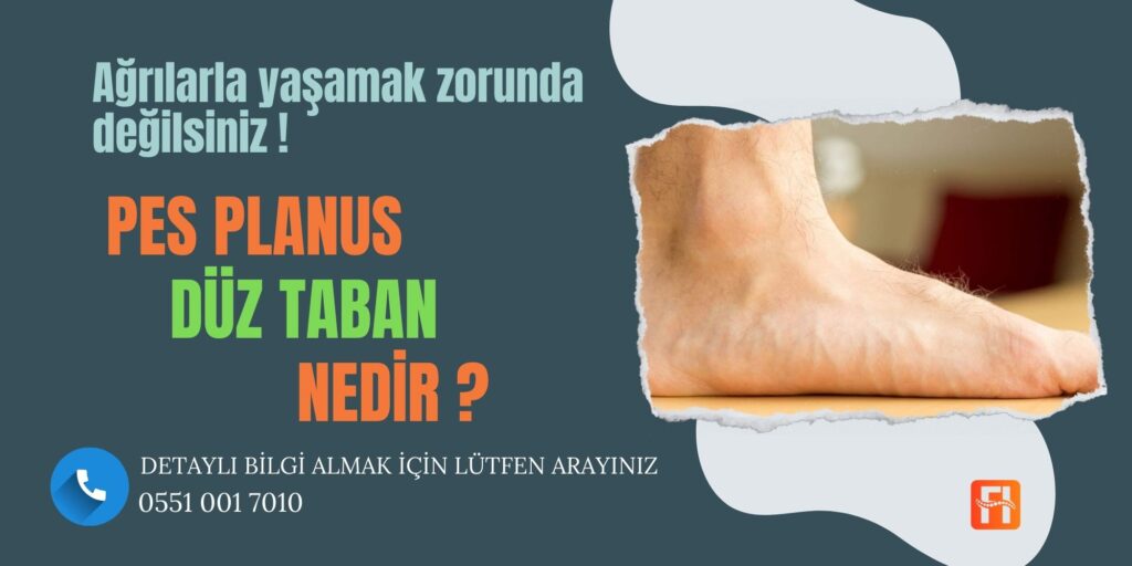 Düz Taban (Pes Planus)
