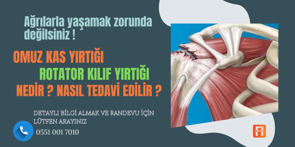 Omuz Kas Yırtığı (Rotator Kılıf Yaralanması)