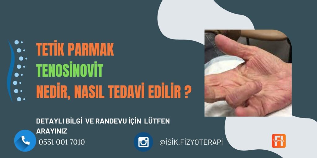 Tetik Parmak Nedir? Nasıl Geçer?