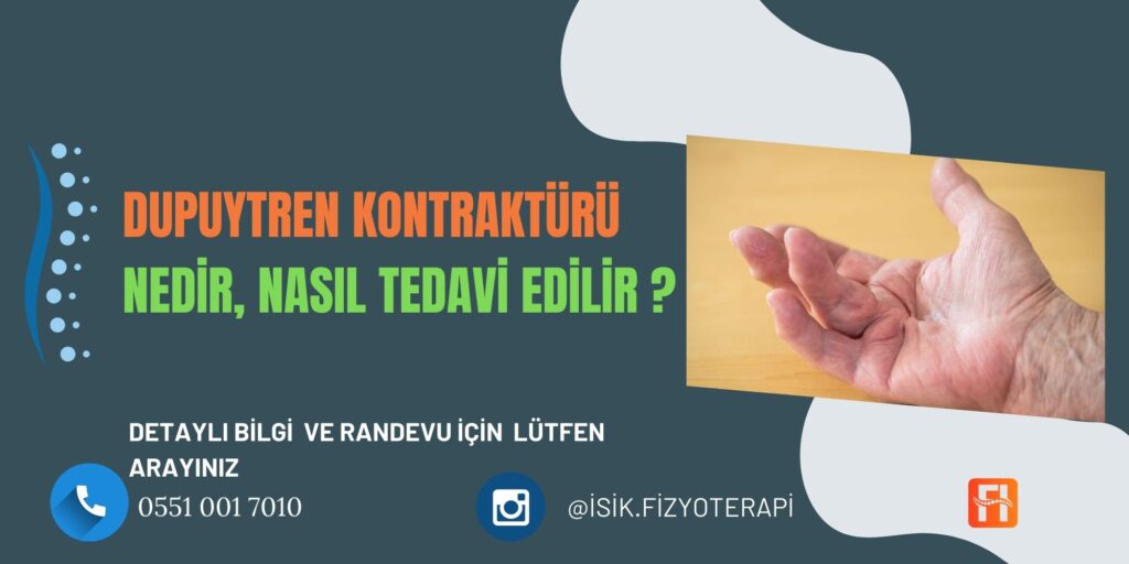 Dupuytren Kontraktürü Nedir?