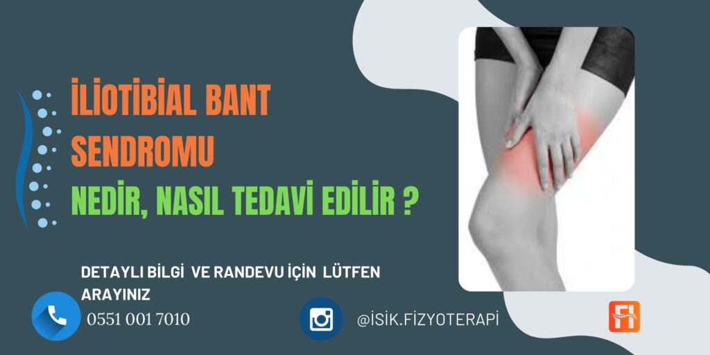İliotibial Bant Sendromu