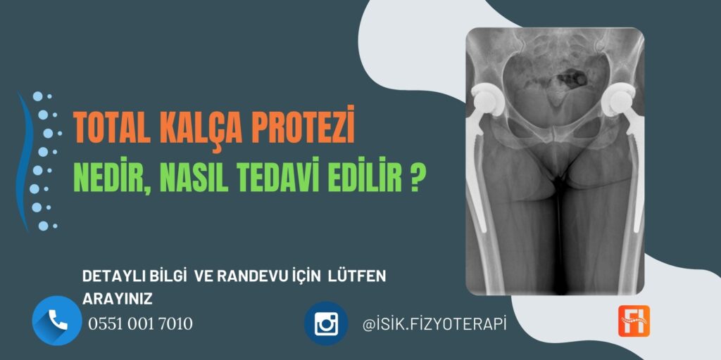 Total Kalça Protezi