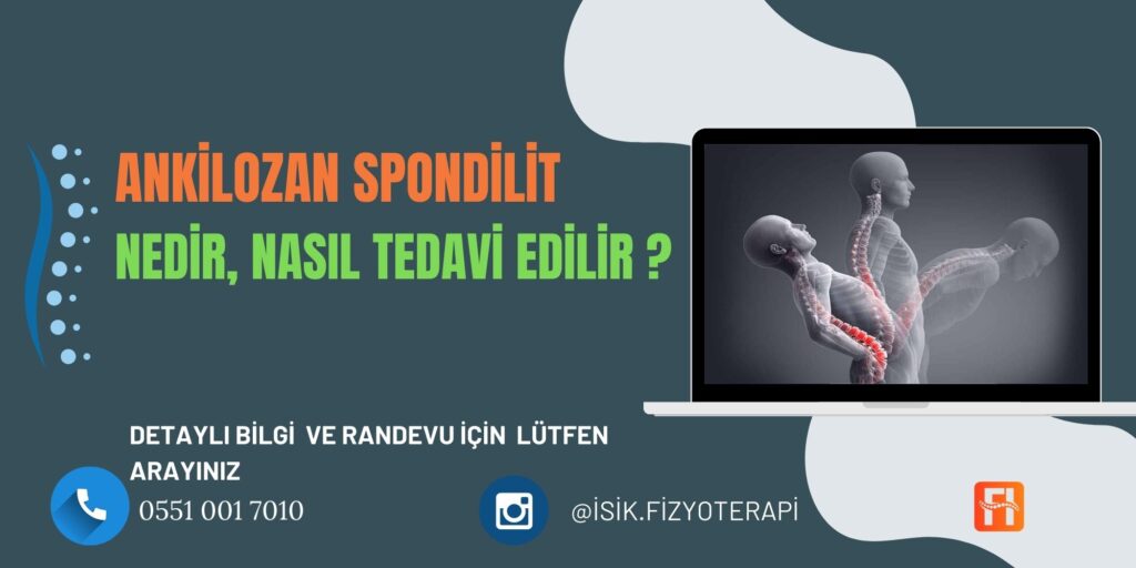 Ankilozan Spondilit